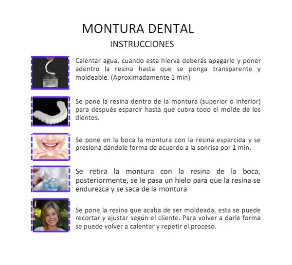Carillas Dentales snap on