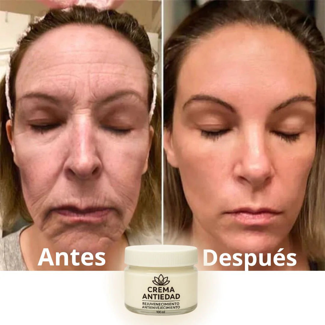 Crema anti edad - anti envejecimiento
