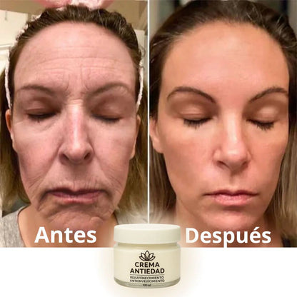 Crema anti edad - anti envejecimiento